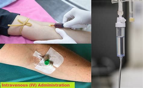 Intravenous injection: Uses, equipment, sites, and more